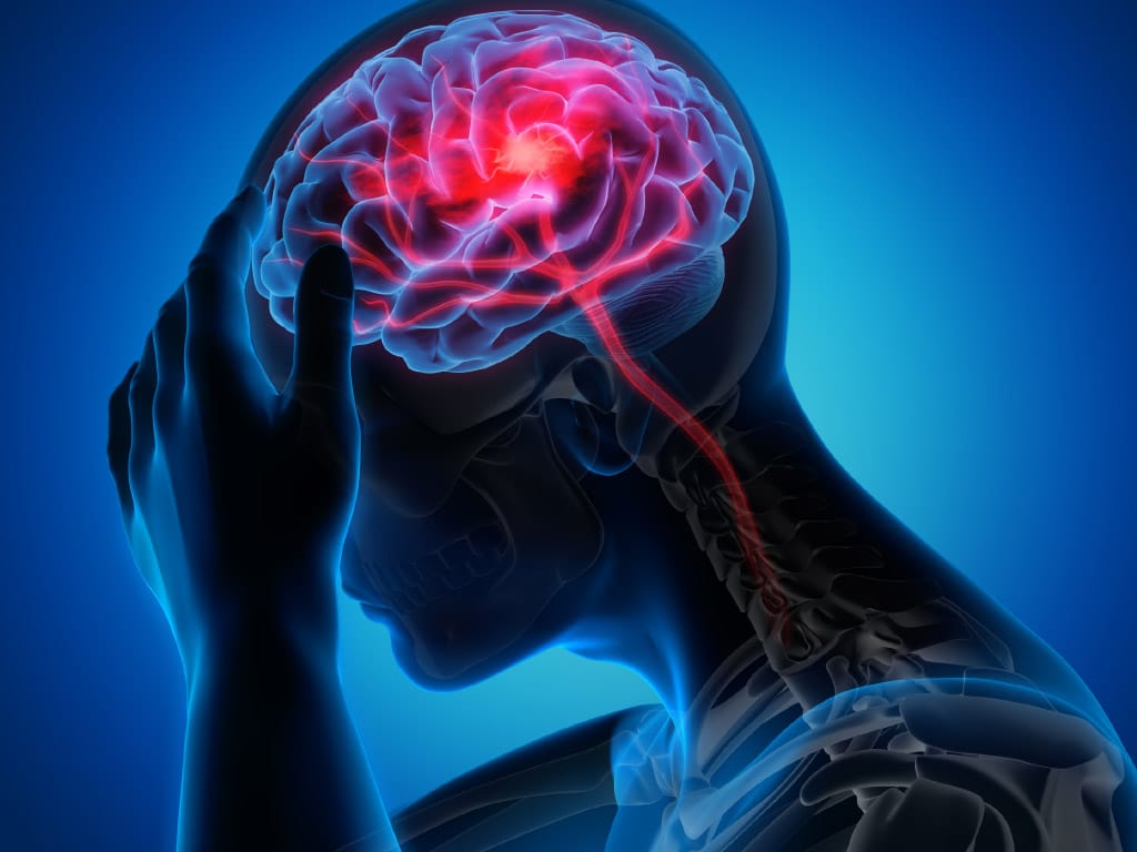 Hoofdpijn weg zonder medicijn 3 hoofdpijn 3