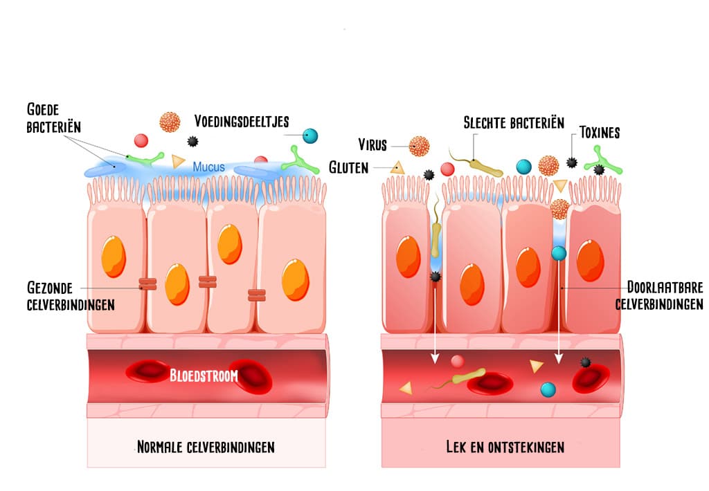 Het Leaky Gut syndroom 1 leaky gut syndroom 2